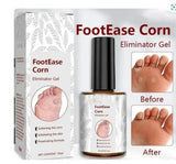 Feet Corn Removal Serum 30ml ( Pack Of 1 ) 16182